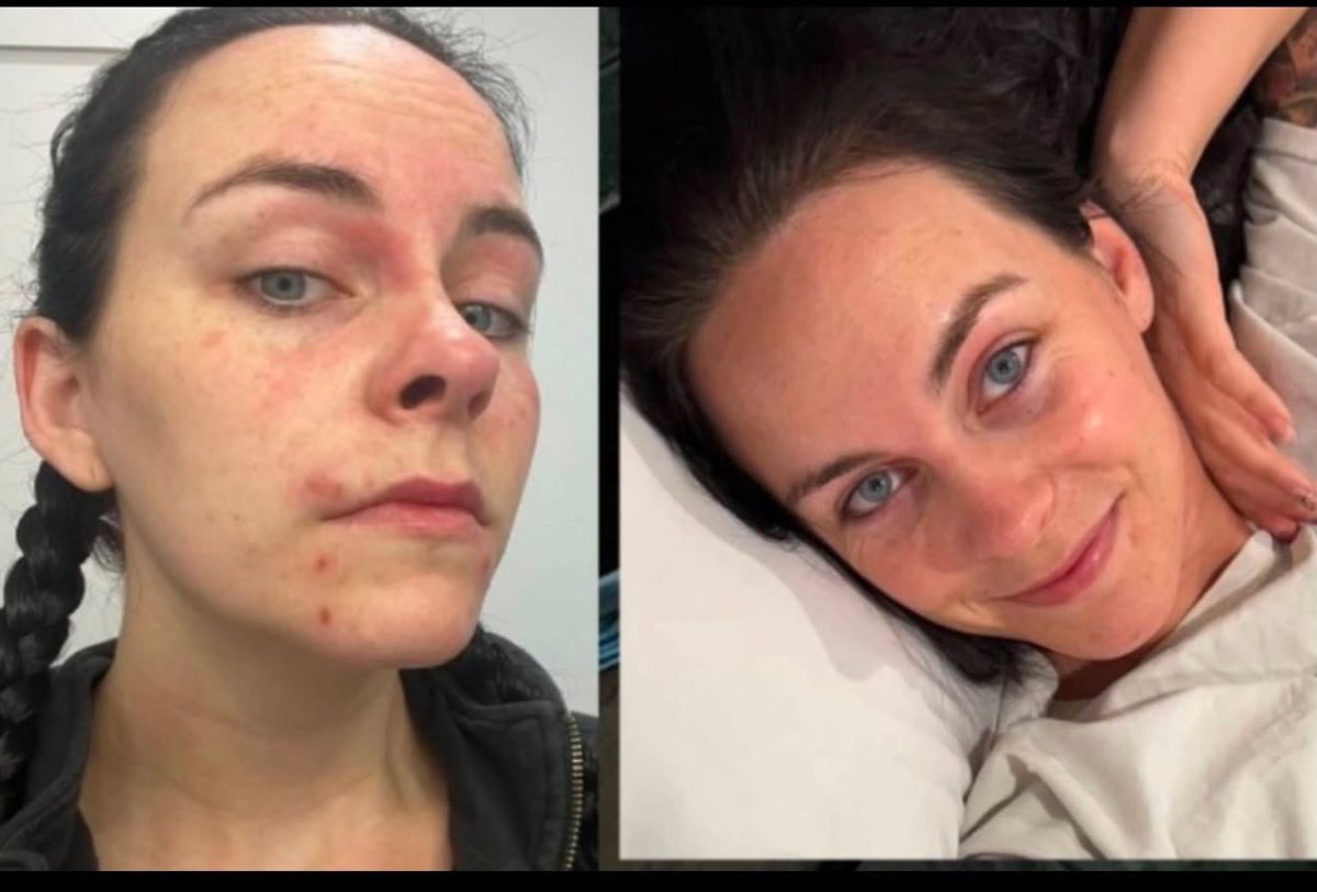 before and after skin